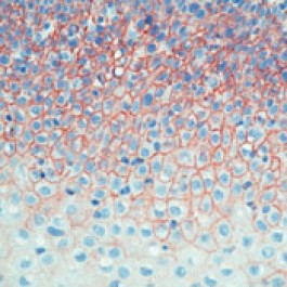 Cd44v6