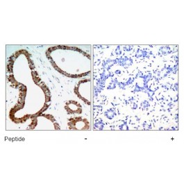 AP02701PU-S