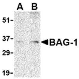 AP05586PU-S