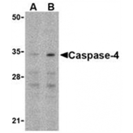 SP2145P