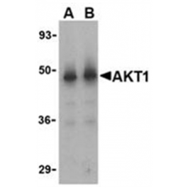 SP2174PS