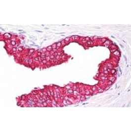 DM182P