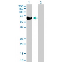 H00000640-D01P