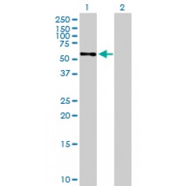 H00009530-B01P
