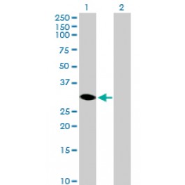 H00051171-B01P