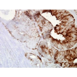 NB110-61640