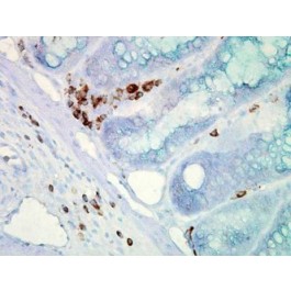 NB110-61582