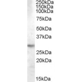 NBP1-06008