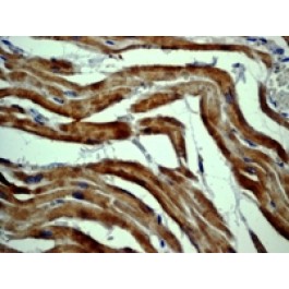 NB110-55433