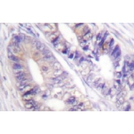 NB100-92268