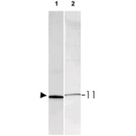 PAB11341