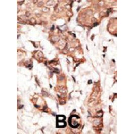 PAB3578