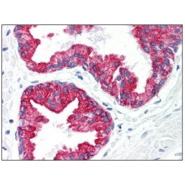 SM3079P