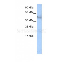 AVARP15002_T100