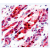 Formalin fixed paraffin embedded human angiosarcoma stained with Flk-1 antibody