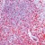 Formalin-fixed, paraffin-embedded human tonsil stained with S100A4 (Cat. AP0588SU-N) using peroxidase-conjugate and AEC chromogen. Note membrane staining of lymphocytes.