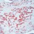 Formalin-fixed, paraffin-embedded human placenta stained with MMP-2 Ab (Cat. AM00257) using peroxidase-conjugate and AEC chromogen. Note cytoplasmic staining of trophoblasts.