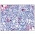 Immunohistochemical staining of lymph node using anti- CCR7 antibody SP4003P