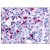 Immunohistochemical staining of tonsil (germinal center) using anti-CCR8 antibody SP4004P