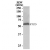 SP7320P 58K Golgi Protein antibody staining of Human Liver Lysate (35 µg protein in RIPA buffer)at 0.03 µg/ml.  Primary incubation was 1 hour.  Detected by chemiluminescence.
 
