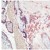 Formalin-fixed, paraffin-embedded human placenta stained with MMP-7 (AM00295PU-N ) using peroxidase-conjugate and AEC chromogen. Note cytoplasmic staining of trophoblasts.
