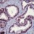 Formalin-fixed, paraffin-embedded human prostate stained with Androgen Receptor (AP00529PU-N) using peroxidase-conjugate and AEC chromogen. Note nuclear staining of glandular epithelium.