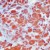 Formalin-fixed, paraffin-embedded human placenta stained with MT-1 (AP00550PU-N) using peroxidase-conjugate and AEC chromogen. Note staining of trophoblasts.