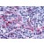 Immunohistochemical staining of dendritic cells using anti-P2Y11 antibody SP4019P