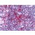 Immunohistochemical staining of tonsil using anti-CCR6 antibody SP4021P