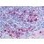 Immunohistochemical staining of tonsil using anti-CCR6 antibody SP4022P