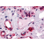 Immunohistochemical staining of Colon (Submucosal Plexus and Submucosal Vessels) using anti- CALCRL antibody SP4082P