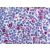 Immunohistochemical staining of Tonsil (Germinal Center) using anti- CCR8 antibody SP4089P