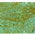 Formalin fixed paraffin embedded human leiomyoma stained with Smooth Muscle Actin antibody DM001.