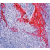 Formalin fixed paraffin embedded human tonsil stained with Cytokeratin 10/13 antibody DM056/DM056-05