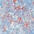 Formalin-fixed, paraffin-embedded human Hodgkin’s lymphoma stained with AM00427SU-N using peroxidase-conjugate and AEC chromogen. Note membrane staining of Hodgkin’s cells and lymphocytes