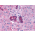 Immunohistochemical staining of Liver and bile ducts  using anti- VIPR2 antibody SP4532P
