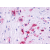 SP4556P P2RY5/LPAR6 antibody staining of Formalin-Fixed Paraffin-Embedded Human Macrophages followed by biotinylated Goat anti-Rabbit IgG secondary antibody, Alkaline Phosphatase-Streptavidin and Chromogen.