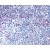 Formalin-Fixed, Paraffin-Embedded Human Lymph Node stained with CCR7 Antibody Cat.-No SP4709P after heat-induced antigen retrieval.