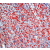 Formalin fixed paraffin embedded human placenta stained with MMP-11 antibody. DM393