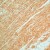 Formalin-fixed, paraffin-embedded human rectum stained with Actin (AM00527PU-N) using peroxidase-conjugate and AEC chromogen. Note cytoplasmic staining of smooth muscles.