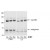 Figure 1. Immunoblotting. Affinity Purified antibody to AKT2 was used at a 1:1,000 dilution to detect AKT2 by Western blot. A lysate from a stable HEK293 cell line expressing an inducible, myristoylated form of Akt2 (MyrAkt2-ER) was loaded for SDSPAGE, separated and then transferred to nitrocellulose. The blot was reacted with primary antibody for 1h at room temperature. In response to 4OHT (tamoxifen), the Akt2 is recruited to the plasma membrane via its myristoylation sequence and becomes phosphorylated and activated. The blot (right panel) shows 0 m, 15 m, and 30 m of 4OHT treatment. This treatment has no effect on endogenous Akt2, but causes a band shift upwards in the MyrAkt2. Endogenous Akt2 runs at about 60kDa whereas the myristoylated construct runs at around 110 kDa.