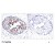 Figure 1. Immunohistochemical analysis of paraffin- embedded human breast carcinoma tissue using STAT5A (phospho-Ser780) antibody AP02348PU.