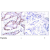 Immunohistochemical analysis of paraffin- embedded human breast carcinoma tissue using c-Jun antibody (AP02547PU-S; AP02547PU-N).