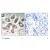 Figure 1. Immunohistochemical analysis of paraffin-embedded human breast carcinoma tissue, using 14-3-3 zeta (Phospho-Ser58) antibody AP02457PU.
