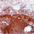 Photomicrograph of human ovary immunostained for estrogen receptor beta using monoclonal antibody SM1682.