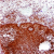 Photomicrograph of human ovary immunostained for estrogen receptor beta using monoclonal antibody SM1682X.