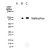 Western blot analysis of phosphorylated Stat6 in NIH 3T3 cells using SM7080P. 
Lane A: Untreated cell lysate. 
Lane B and C: Anisomycin or EGF treated cell lysates, respectively.