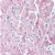 Figure 1. BP508 GLUT4 antibody staining of Paraffin Embedded Human Heart, demonstrating labelling of cardiac myocytes.