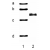 Lane 1: Phosphorylase B (a), BSA (b), Ovalbumin (c), Carbonic Anhydrase (d). Lane 2: keratin K8