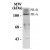 Western blot of whole cell T47D lysate prepared from cells that had been incubated in the presence of the synthetic progestin agonist R5020 (500 nM) showing specific labeling of the ~90 kDa PR-A isorform and the ~120 kDa PR-B isoform of the Progesterone Receptor phosphorylated at Ser190.
